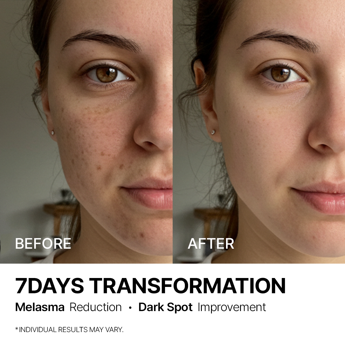 Rein Haut Melz Cream